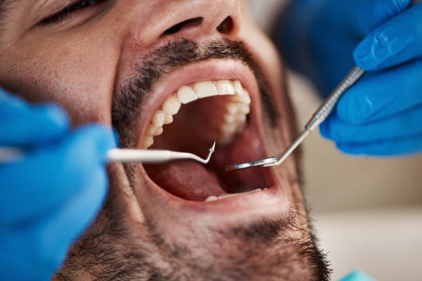 Best Emergency Dentist for Knocked-Out Tooth in Despard, WV