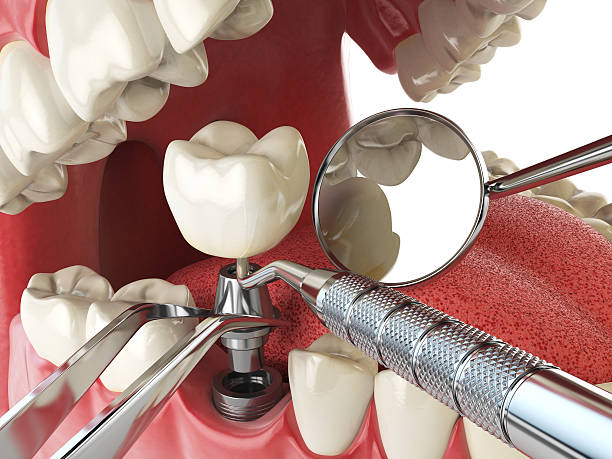 Best Broken or Cracked Tooth Emergency Dentist in Despard, WV